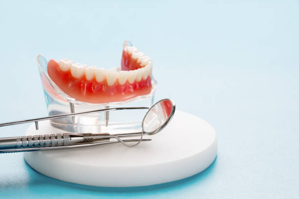 Full Mouth Reconstruction in Valdese, NC